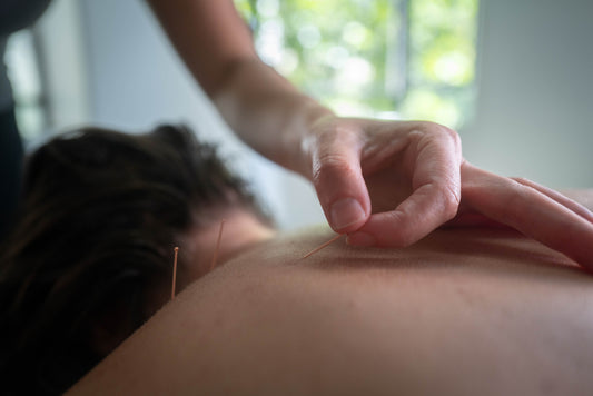 What is dry needling?